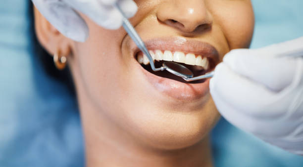 Best Emergency Dentist for Lost Fillings or Crowns in Wheeler, TX