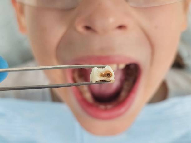 Best Orthodontic Emergency Dentist in Wheeler, TX