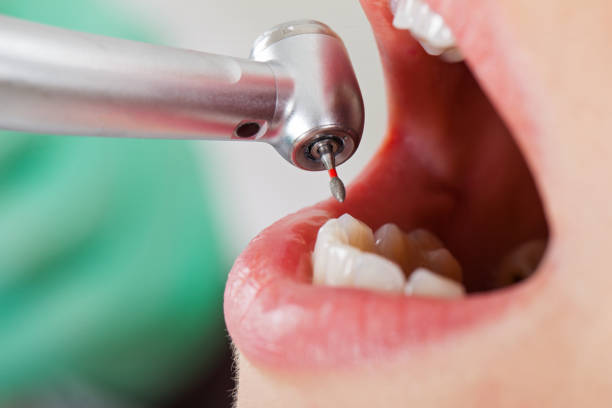 Best Emergency Dental Services for Seniors in Wheeler, TX